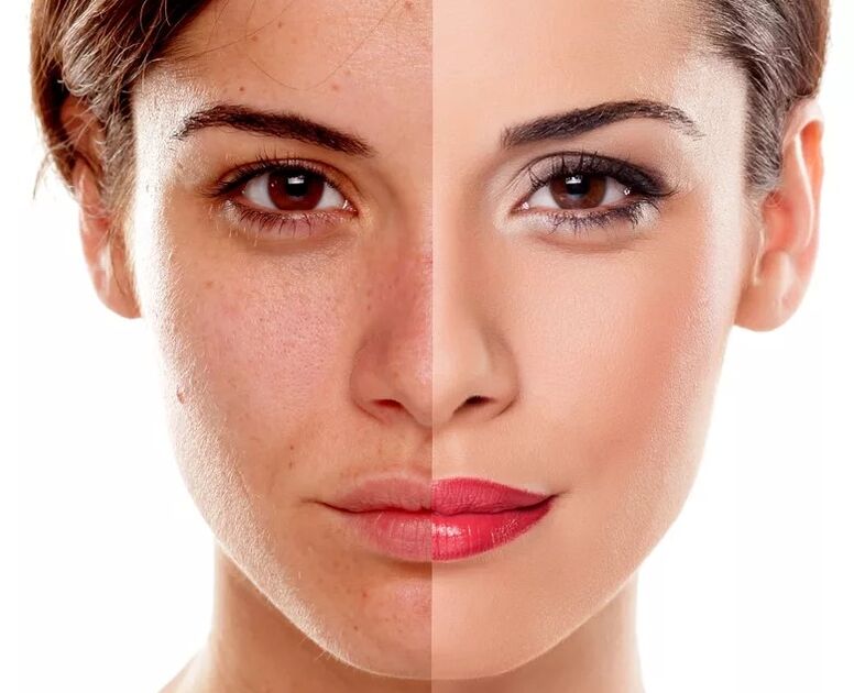 A flat skin tone